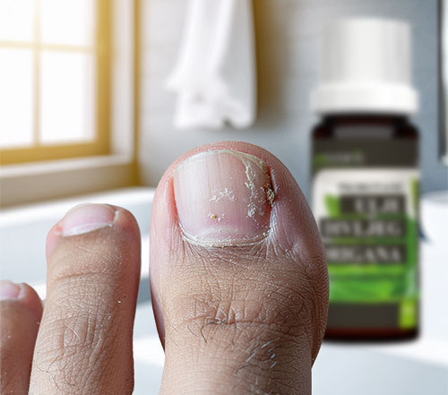 Kako-izleciti-gljivice-na-noktima-prirodnim-putem